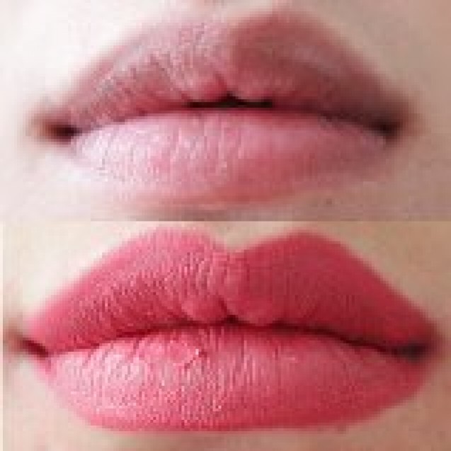 perbandingan bibir