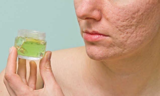 Menghilangkan Jerawat dengan Acne Fighting