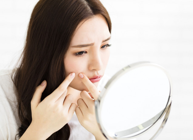 Tips merawat wajah untuk tidak memencet jerawat